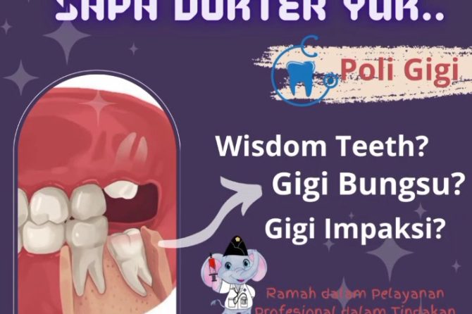 SAPA DOKTER YUK.. Edisi Poli Gigi : “Gigi Bungsu”